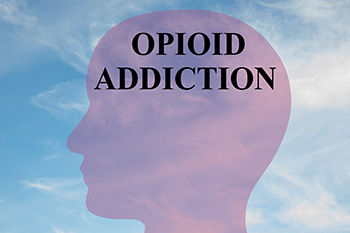 opioid addiction